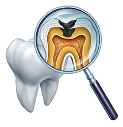 Riverdale Dental Arts | Periodontal Treatment, Oral Exams and Preventative Program