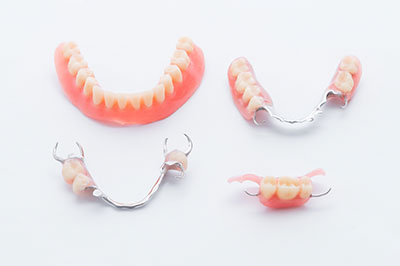 Riverdale Dental Arts | Dental Sealants, Implant Dentistry and Veneers