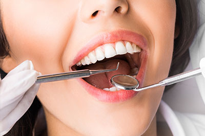 Riverdale Dental Arts | Teeth Whitening, Intraoral Camera and Dental Fillings